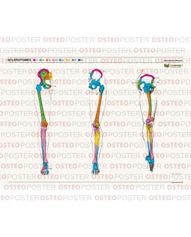 Osteoposter Sclerotomi  Gambe