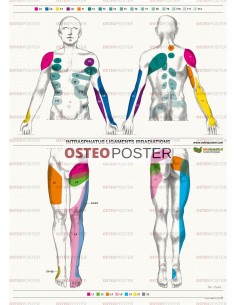 Osteoposter - Irradiazione Legamenti Interspinosi Verticale
