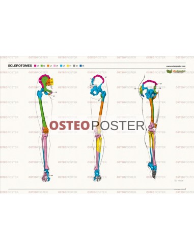 Osteoposter - Sclerotomi Gambe